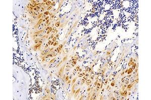 Immunohistochemistry analysis of paraffin-embedded mouse bone using MAGEC1 Polyclonal Antibody at dilution of 1:300. (MAGEC1 抗体)