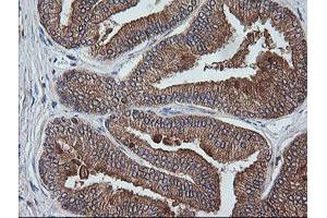 Image no. 8 for anti-V-Ets Erythroblastosis Virus E26 Oncogene Homolog 2 (ETS2) (AA 90-349) antibody (ABIN1491702)