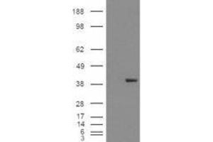 Western Blotting (WB) image for Aldo-Keto Reductase Family 1, Member B1 (Aldose Reductase) (AKR1B1) peptide (ABIN370286)