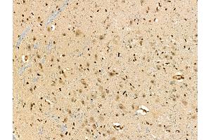 ABIN7093294 and ABIN7097313 at 1/100 staining Rat brain tissue by IHC-P. (ZFP36L1 抗体  (pSer92))