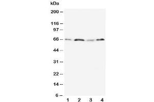 Western blot testing of OPN antibody and Lane 1:  MM231 (Osteopontin 抗体  (N-Term))