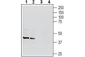 anti-Hydroxycarboxylic Acid Receptor 2 (HCAR2) (AA 82-94), (Extracellular) antibody