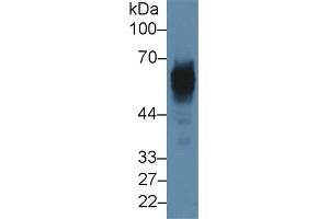 Detection of CK5 in Rat Skin lysate using Polyclonal Antibody to Cytokeratin 5 (CK5) (Cytokeratin 5 抗体  (AA 335-473))