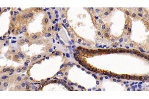 Immunohistochemistry (IHC) image for anti-Keratin 6A (KRT6A) (AA 163-468) antibody (ABIN7435445)