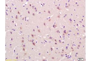 Formalin-fixed and paraffin embedded rat brain labeled with Anti-OB/CDH11/OB-Cadherin Polyclonal Antibody, Unconjugated (ABIN1387539) at 1:200 followed by conjugation to the secondary antibody and DAB staining. (OB Cadherin 抗体  (AA 310-360))