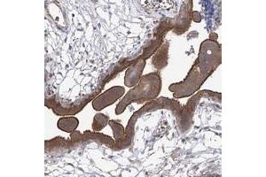 Immunohistochemical staining of human placenta with CPEB4 polyclonal antibody  shows strong membranous and cytoplasmic positivity in trophoblastic cells at 1:200-1:500 dilution. (CPEB4 抗体)