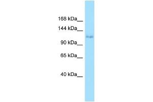 WB Suggested Anti-EPHA6 Antibody Titration: 1. (EPH Receptor A6 抗体  (N-Term))