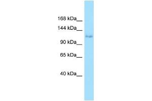 WB Suggested Anti-EPHA6 Antibody Titration: 1. (EPH Receptor A6 抗体  (N-Term))