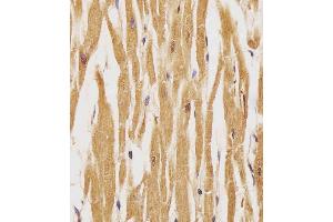 (ABIN389572 and ABIN2839598) staining HER4 in human heart tissue sections by Immunohistochemistry (IHC-P - paraformaldehyde-fixed, paraffin-embedded sections). (ERBB4 抗体  (pTyr1162))