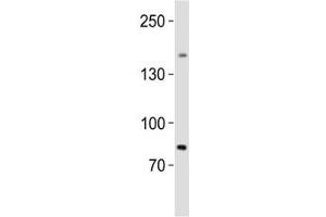 Western blot analysis of lysate from human testis tissue lysate using SALL4 antibody diluted at 1:1000. (SALL4 抗体  (AA 1035-1069))