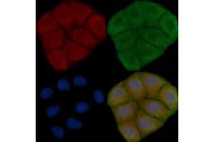 ABIN6259081 and ABIN6273900 staining Hela cells(30 min of UV treatment) by IF/ICC. (Purinergic Receptor P2Y, G-Protein Coupled, 13 (P2RY13) (C-Term) 抗体)