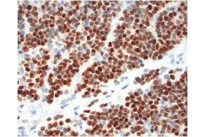 Immunohistochemistry (IHC) image for anti-Myogenin (Myogenic Factor 4) (MYOG) antibody (ABIN953581) (Myogenin 抗体)