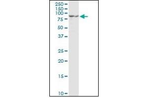 Western Blotting (WB) image for anti-Proprotein Convertase Subtilisin/kexin Type 1 (PCSK1) (AA 652-754) antibody (ABIN781869)