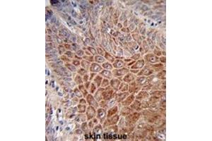Immunohistochemistry (IHC) image for anti-Immunoglobulin Heavy Chain (IgH) antibody (ABIN2995207) (IgH 抗体)