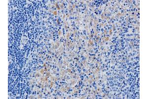 Immunohistochemical staining of rat spleen using anti-IL2R antibody  Formalin fixed rat spleen slices were were stained with  at 5 µg/ml. (Recombinant IL2RA (Daclizumab Biosimilar) 抗体)