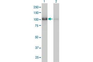 Western Blotting (WB) image for anti-CCR4-NOT Transcription Complex, Subunit 3 (CNOT3) (AA 1-100) antibody (ABIN562024)