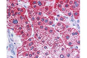 Immunohistochemistry (IHC) image for anti-Hydroxyacyl-CoA Dehydrogenase/3-Ketoacyl-CoA Thiolase/enoyl-CoA Hydratase (Trifunctional Protein), beta Subunit (HADHB) (C-Term) antibody (ABIN2783232)