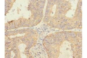 Immunohistochemistry (IHC) image for anti-Salvador Homolog 1 (SAV1) (AA 1-210) antibody (ABIN7166095)