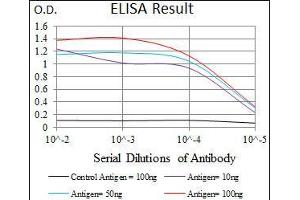 Black line: Control Antigen (100 ng), Purple line: Antigen(10 ng), Blue line: Antigen (50 ng), Red line: Antigen (100 ng), (Somatostatin 抗体  (AA 1-116))