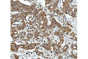 IHC analysis of CBR1 using anti-CBR1 antibody (ABIN7600015). (CBR1 抗体  (AA 14-262))