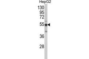 Western Blotting (WB) image for anti-Cytochrome P450, Family 2, Subfamily J, Polypeptide 2 (CYP2J2) antibody (ABIN3003218) (CYP2J2 抗体)