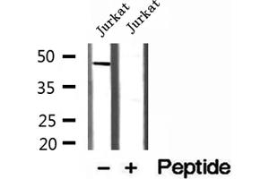 Western blot analysis of extracts of Jurkat cells, using MAGT1 antibody. (MAGT1 抗体  (Internal Region))
