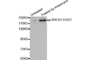 Western blot analysis of extracts from HT29 cells, using Phospho-BRCA1-S1423 antibody (BRCA1 抗体  (pSer1423))