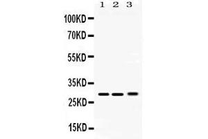 Western blot analysis of PSMA3 expression in rat testis extract ( Lane 1), mouse lung extract ( Lane 2) and 293T whole cell lysates ( Lane 3). (PSMA3 抗体  (Middle Region))