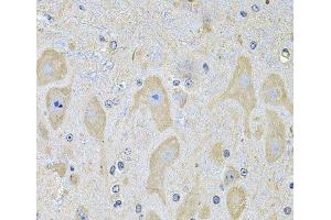 Immunohistochemistry of paraffin-embedded Mouse brain using EPHA2 Polyclonal Antibody at dilution of 1:100 (40x lens). (EPH Receptor A2 抗体)