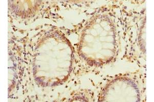 Immunohistochemistry (IHC) image for anti-Phosphatidic Acid Phosphatase Type 2C (PPAP2C) (AA 109-162) antibody (ABIN7163353)