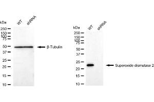 Western blotting analysis using Superoxide dismutase 2 antibody (ABIN7800463). (Recombinant SOD2 抗体)
