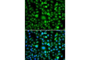 Immunofluorescence analysis of MCF-7 cells using TEK antibody (ABIN5974350). (TEK 抗体)