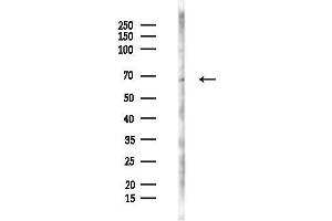 Western blot analysis of lysates from B16F10-LUC cells(starvation 24h treatment), using Phospho-PAK1 (Ser199) Antibody at 1/1000 dilution.