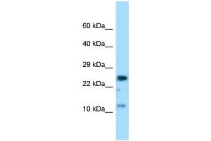 Host: Rabbit Target Name: COX7A2 Sample Type: MCF7 Whole Cell lysates Antibody Dilution: 1. (COX7A2 抗体  (Middle Region))