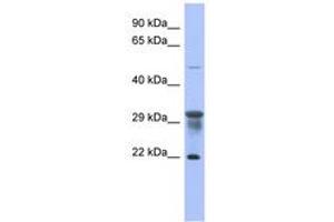 Image no. 1 for anti-Phosphomannomutase 1 (PMM1) (N-Term) antibody (ABIN6744071) (PMM1 抗体  (N-Term))