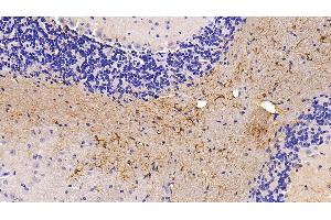 Immunohistochemistry (IHC) image for anti-Glial Fibrillary Acidic Protein (GFAP) (AA 253-354) antibody (ABIN7430747)