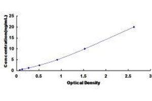 ELISA image for Signal Transducer and Activator of Transcription 1, 91kDa (STAT1) ELISA Kit (ABIN417224)