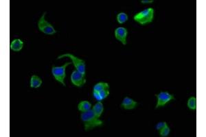 Immunofluorescence staining of MCF-7 cells with ABIN7175412 at 1:200, counter-stained with DAPI. (AVPR2 抗体  (AA 221-271))