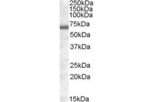 Image no. 1 for anti-Collagen, Type IV, alpha 3 (Goodpasture Antigen) Binding Protein (COL4A3BP) (AA 396-411) antibody (ABIN308432)