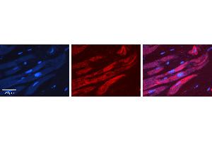 Rabbit Anti-ALAD Antibody   Formalin Fixed Paraffin Embedded Tissue: Human heart Tissue Observed Staining: Cytoplasmic Primary Antibody Concentration: 1:100 Other Working Concentrations: N/A Secondary Antibody: Donkey anti-Rabbit-Cy3 Secondary Antibody Concentration: 1:200 Magnification: 20X Exposure Time: 0. (ALAD 抗体  (Middle Region))