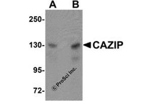 Western Blotting (WB) image for anti-Microtubule-associated Tumor Suppressor Candidate 2 (MTUS2) (C-Term) antibody (ABIN1030322) (CAZIP 抗体  (C-Term))