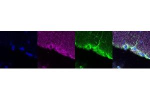Immunohistochemistry (IHC) image for anti-Coiled-Coil Domain Containing 153 (CCDC153) antibody (ABIN7456016) (CCDC153 抗体)