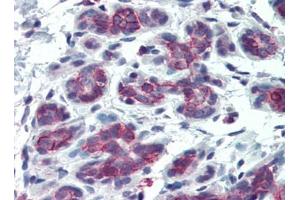 Human Breast (formalin-fixed, paraffin-embedded) stained with SDC1at 15 µg/ml followed by biotinylated goat anti-rabbit IgG secondary antibody, alkaline phosphatase-streptavidin and chromogen. (Syndecan 1 抗体  (AA 18-218))