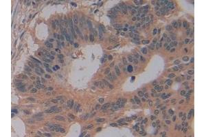 Immunohistochemistry (IHC) image for anti-Glutathione S-Transferase mu 4 (GSTM4) (AA 18-215) antibody (ABIN7439909)