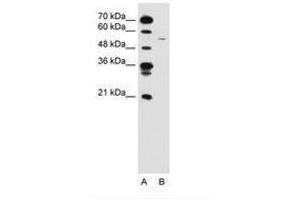 Image no. 1 for anti-Cyclin B1 (CCNB1) (C-Term) antibody (ABIN6736592) (Cyclin B1 抗体  (C-Term))