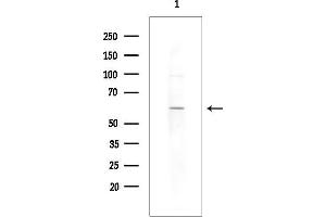 Western blot analysis of lysates from Rat brain, using  Antibody at 1/1000 dilution.