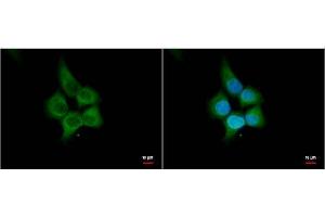 ICC/IF Image HHIP antibody [N3C2], Internal antibody detects HHIP protein by immunofluorescent analysis. (HHIP 抗体)