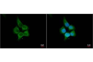 ICC/IF Image HHIP antibody [N3C2], Internal antibody detects HHIP protein by immunofluorescent analysis. (HHIP 抗体)
