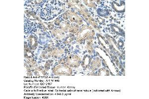 Rabbit Anti-PRPS2 Antibody  Paraffin Embedded Tissue: Human Kidney Cellular Data: Epithelial cells of renal tubule Antibody Concentration: 4. (PRPS2 抗体  (Middle Region))