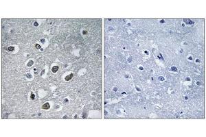 Immunohistochemistry analysis of paraffin-embedded human brain tissue using MARCH4 antibody. (MARCH4 抗体  (C-Term))